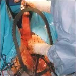 日韩堕胎男婴图片视频在线观看,揭示日韩堕胎男婴图片视频背后的社会现象